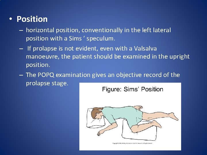  • Position – horizontal position, conventionally in the left lateral position with a