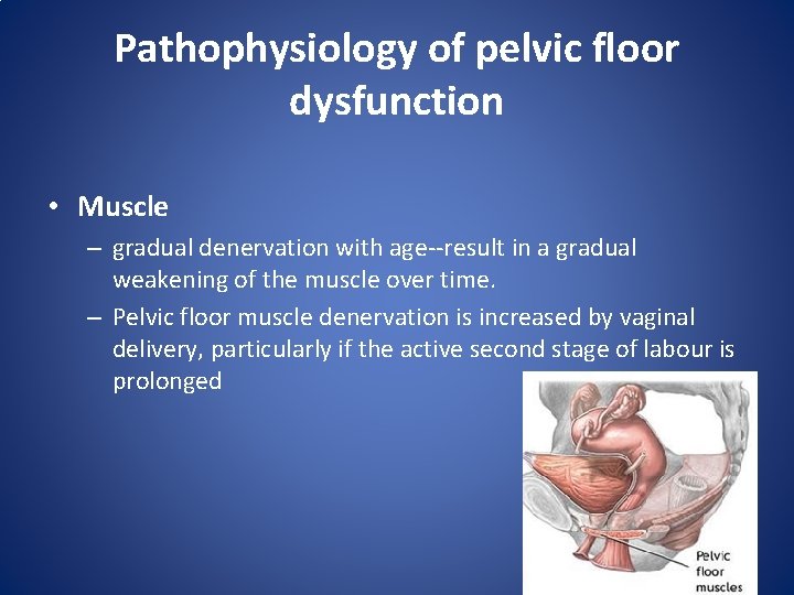 Pathophysiology of pelvic floor dysfunction • Muscle – gradual denervation with age--result in a