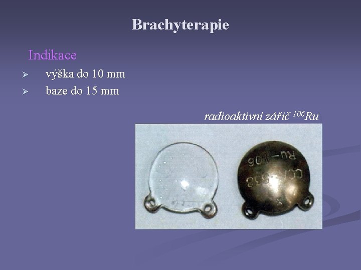 Brachyterapie Indikace Ø Ø výška do 10 mm baze do 15 mm radioaktivní zářič