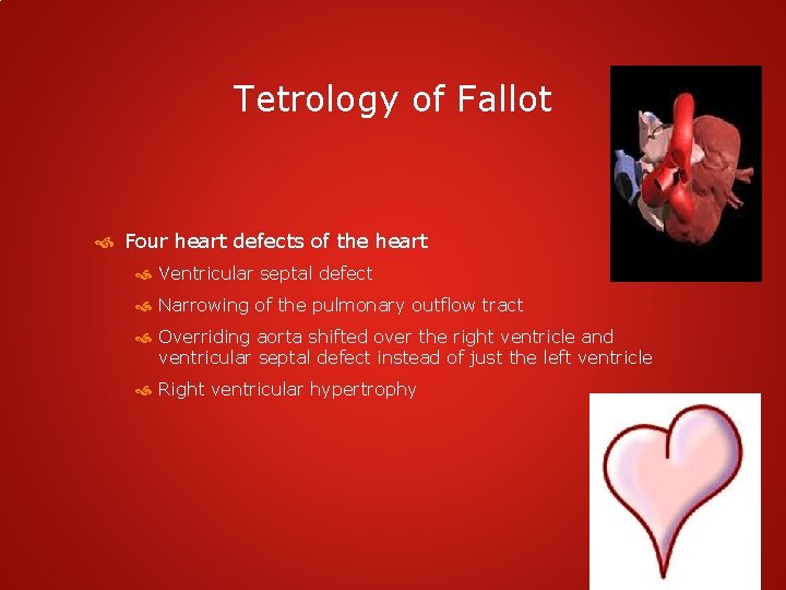 Tetrology of Fallot Four heart defects of the heart Ventricular septal defect Narrowing of