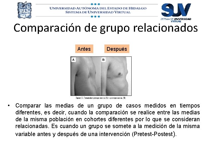 Comparación de grupo relacionados Antes Después • Comparar las medias de un grupo de