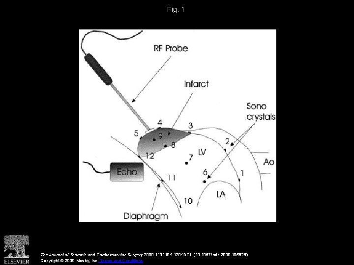 Fig. 1 The Journal of Thoracic and Cardiovascular Surgery 2000 1191194 -1204 DOI: (10.