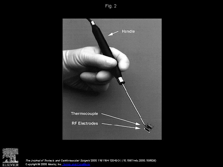 Fig. 2 The Journal of Thoracic and Cardiovascular Surgery 2000 1191194 -1204 DOI: (10.