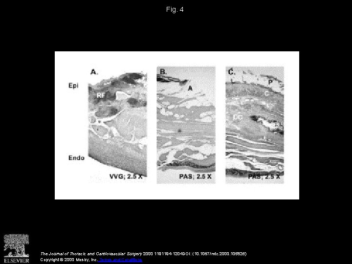 Fig. 4 The Journal of Thoracic and Cardiovascular Surgery 2000 1191194 -1204 DOI: (10.