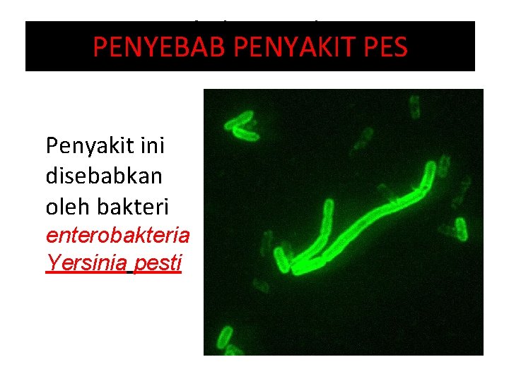 Penyebab Penyakit Pes PENYEBAB PENYAKIT PES Penyakit ini disebabkan oleh bakteri enterobakteria Yersinia pesti