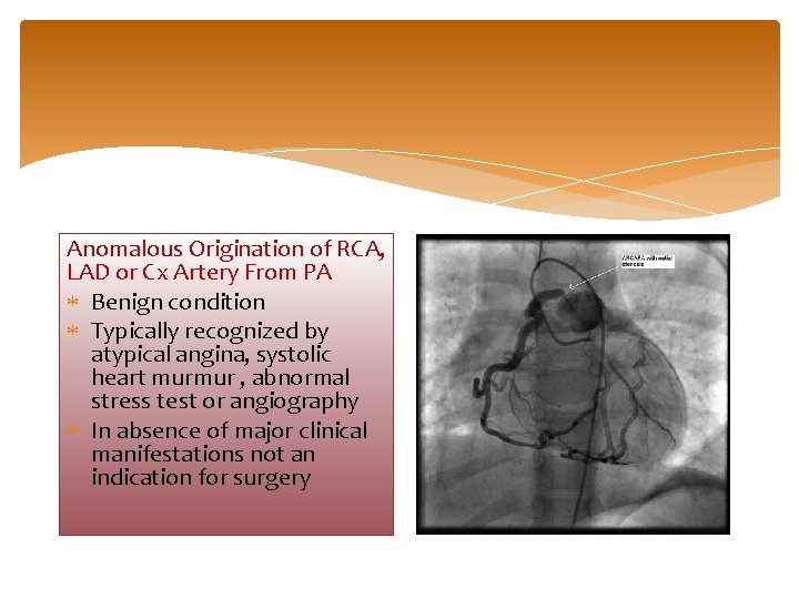 Anomalous Origination of RCA, LAD or Cx Artery From PA Benign condition Typically recognized