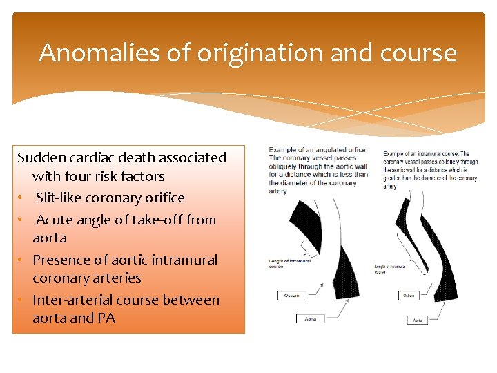 Anomalies of origination and course Sudden cardiac death associated with four risk factors •