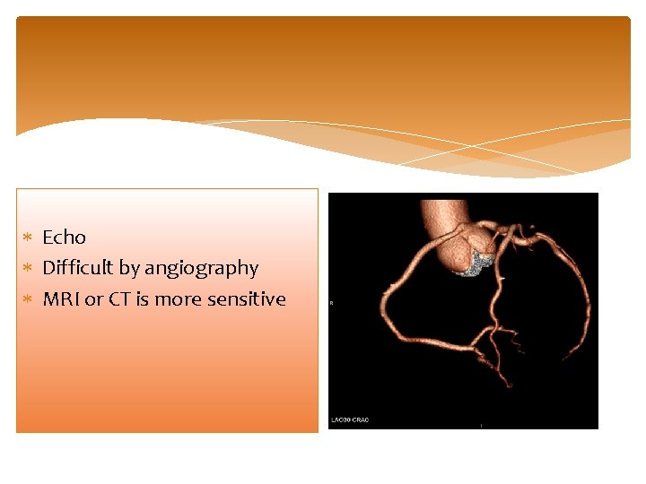  Echo Difficult by angiography MRI or CT is more sensitive 