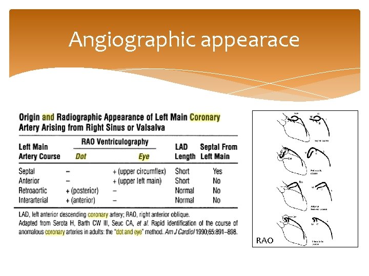 Angiographic appearace RAO 