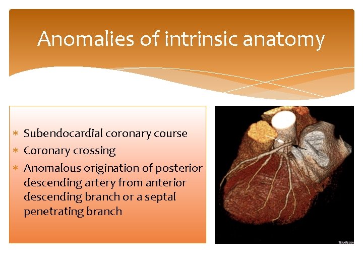 Anomalies of intrinsic anatomy Subendocardial coronary course Coronary crossing Anomalous origination of posterior descending