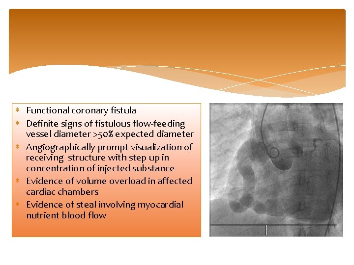  Functional coronary fistula Definite signs of fistulous flow-feeding vessel diameter >50% expected diameter