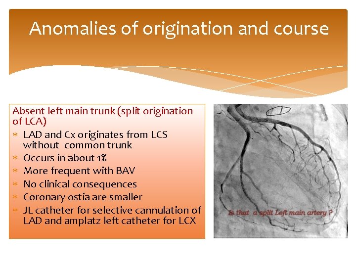 Anomalies of origination and course Absent left main trunk (split origination of LCA) LAD