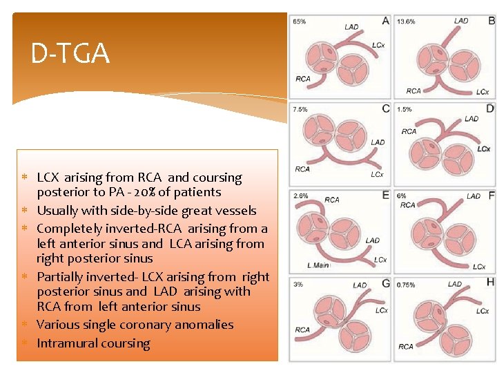 D-TGA LCX arising from RCA and coursing posterior to PA - 20% of patients