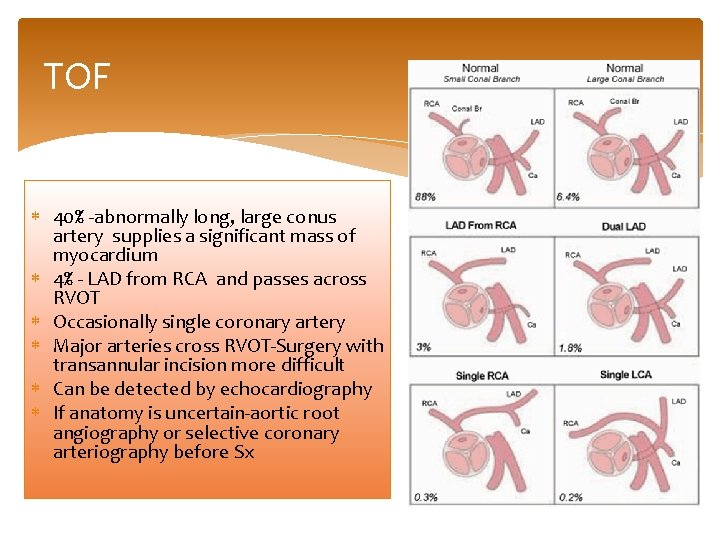 TOF 40% -abnormally long, large conus artery supplies a significant mass of myocardium 4%