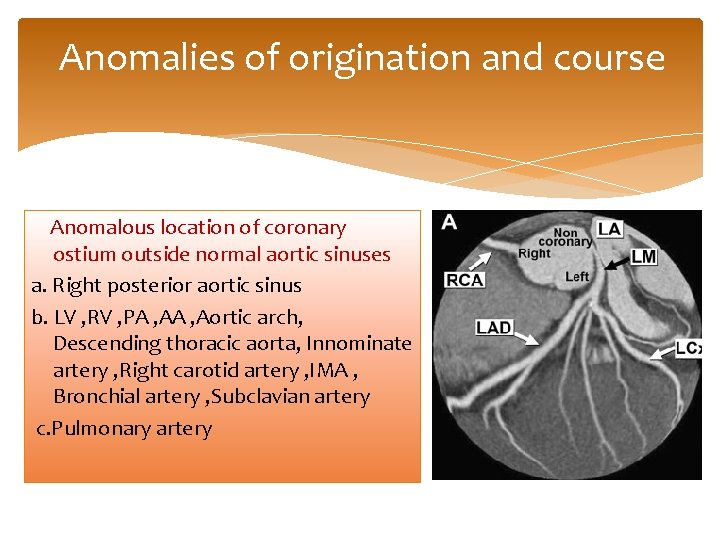 Anomalies of origination and course Anomalous location of coronary ostium outside normal aortic sinuses
