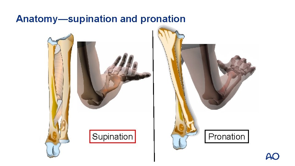 Forearm shaft fractures Volker Braunstein Learning outcomes At