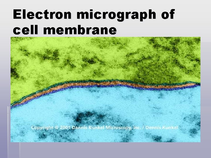 Electron micrograph of cell membrane 