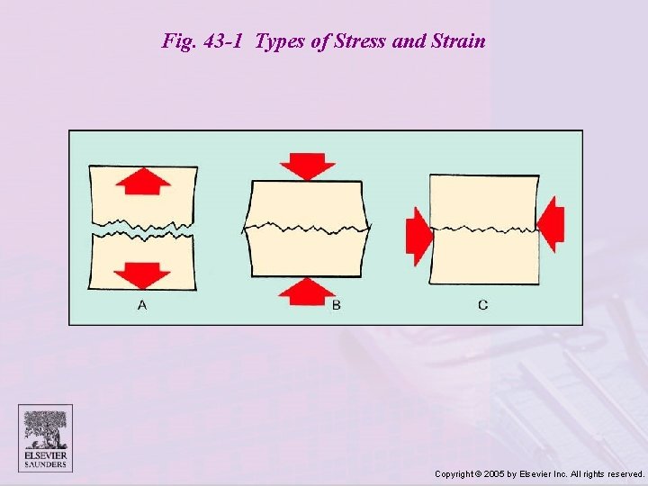Fig. 43 -1 Types of Stress and Strain Copyright © 2005 by Elsevier Inc.
