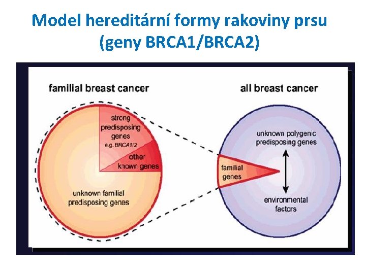 Model hereditární formy rakoviny prsu (geny BRCA 1/BRCA 2) 