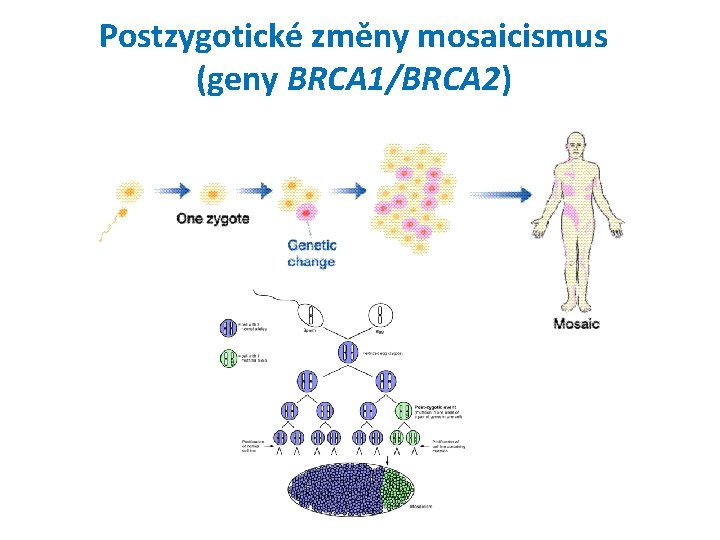 Postzygotické změny mosaicismus (geny BRCA 1/BRCA 2) 