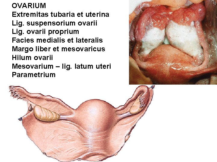 OVARIUM Extremitas tubaria et uterina Lig. suspensorium ovarii Lig. ovarii proprium Facies medialis et