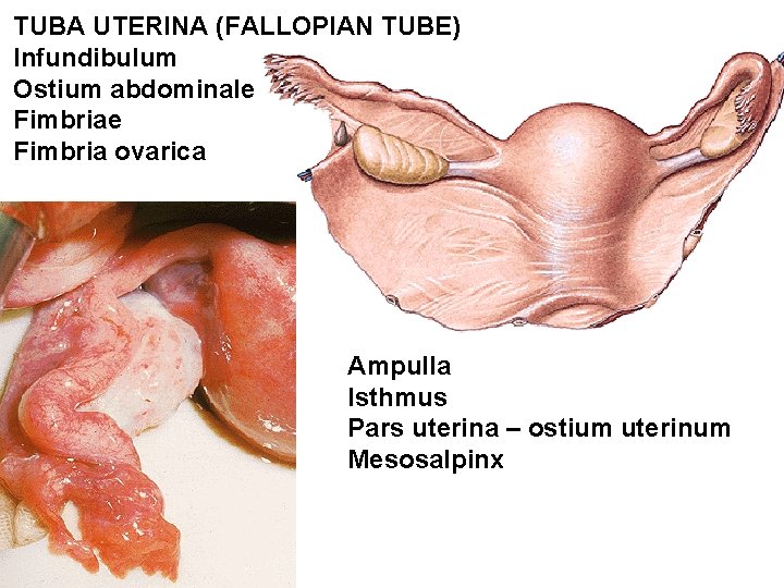 TUBA UTERINA (FALLOPIAN TUBE) Infundibulum Ostium abdominale Fimbria ovarica Ampulla Isthmus Pars uterina –