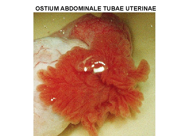 OSTIUM ABDOMINALE TUBAE UTERINAE 