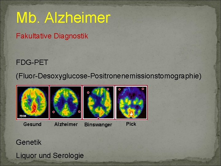 Mb. Alzheimer Fakultative Diagnostik FDG-PET (Fluor-Desoxyglucose-Positronenemissionstomographie) Gesund Alzheimer Genetik Liquor und Serologie Binswanger Pick