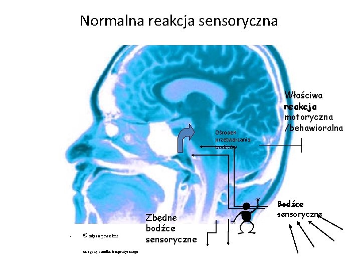 Normalna reakcja sensoryczna Ośrodek przetwarzania bodźców • © zdjęcie powielone • za zgodą ośrodka