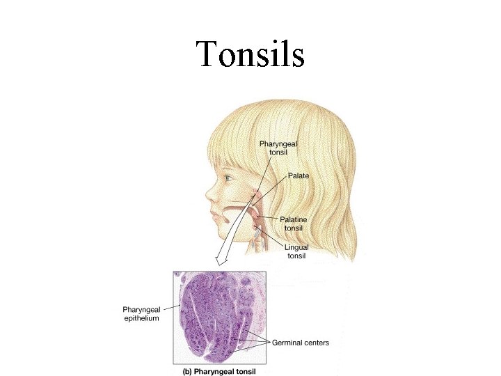 Tonsils 