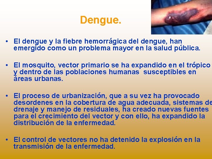 Dengue. • El dengue y la fiebre hemorrágica del dengue, han emergido como un