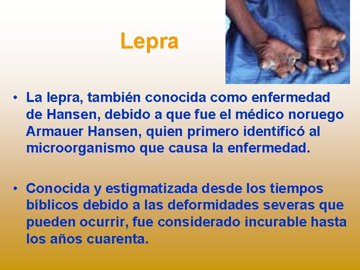 Lepra • La lepra, también conocida como enfermedad de Hansen, debido a que fue