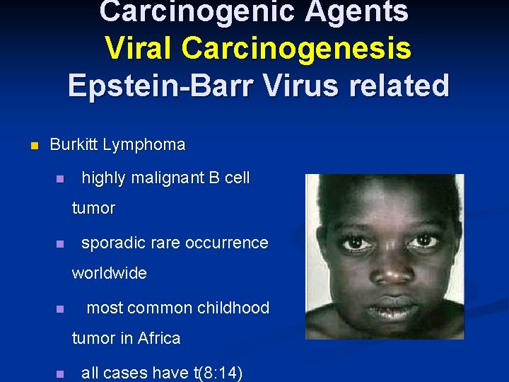 Carcinogenic Agents Viral Carcinogenesis Epstein-Barr Virus related n Burkitt Lymphoma n highly malignant B