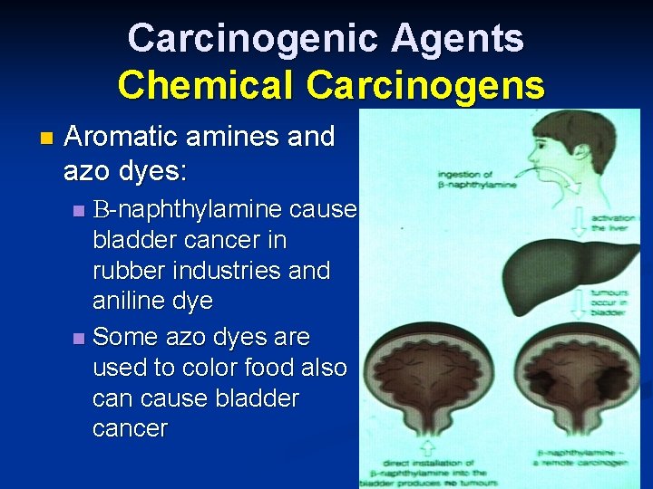 Carcinogenic Agents Chemical Carcinogens n Aromatic amines and azo dyes: B-naphthylamine cause bladder cancer