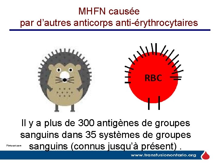 MHFN causée par d’autres anticorps anti-érythrocytaires Il y a plus de 300 antigènes de MHFN causée par d’autres anticorps anti-érythrocytaires Il y a plus de 300 antigènes de