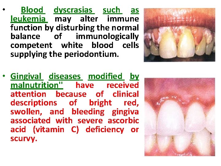 • Blood dyscrasias such as leukemia may alter immune function by disturbing the • Blood dyscrasias such as leukemia may alter immune function by disturbing the