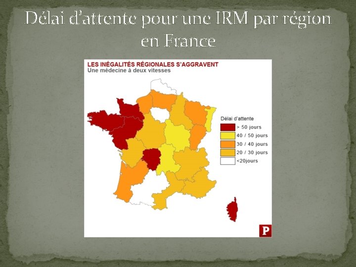 Délai d’attente pour une IRM par région en France 