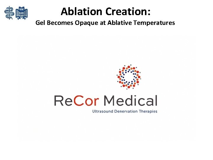 Ablation Creation: Gel Becomes Opaque at Ablative Temperatures 