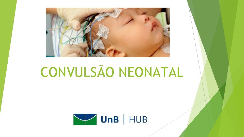 CONVULSÃO NEONATAL 