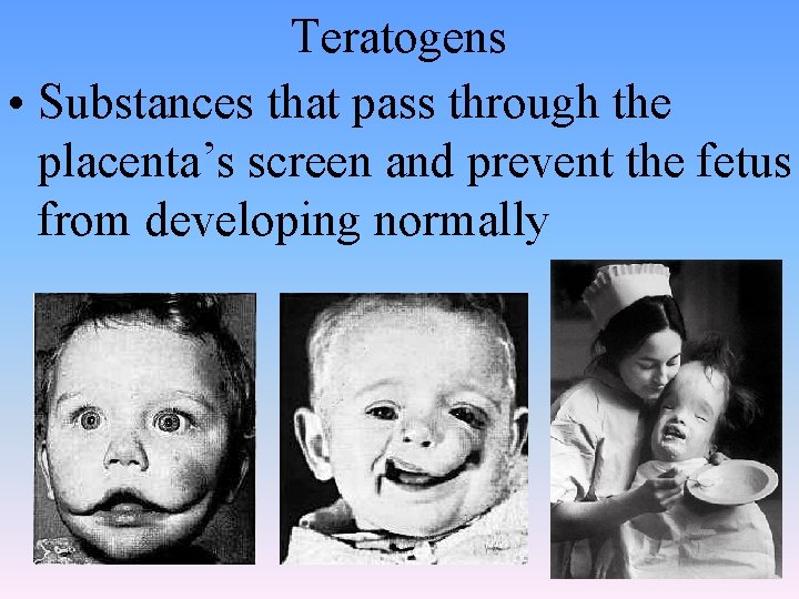 Teratogens • Substances that pass through the placenta’s screen and prevent the fetus from