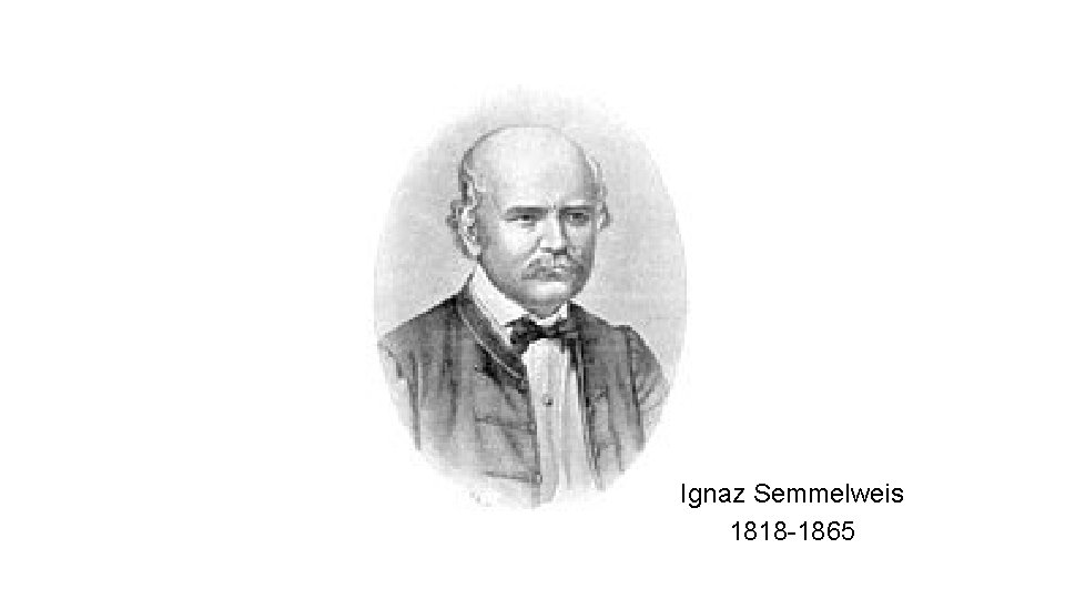Ignaz Semmelweis 1818 -1865 