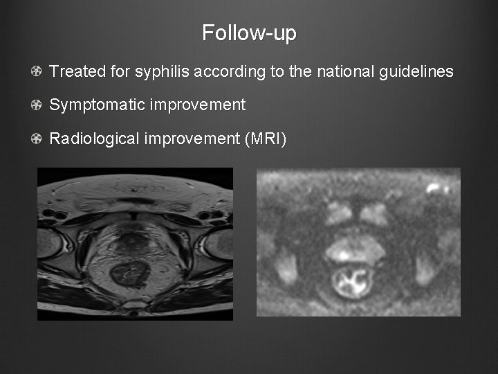 Follow-up Treated for syphilis according to the national guidelines Symptomatic improvement Radiological improvement (MRI)