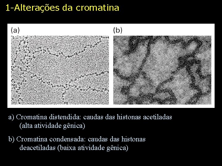 1 -Alterações da cromatina a) Cromatina distendida: caudas histonas acetiladas (alta atividade gênica) b)