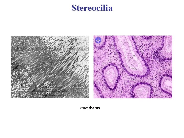 Stereocilia epididymis 