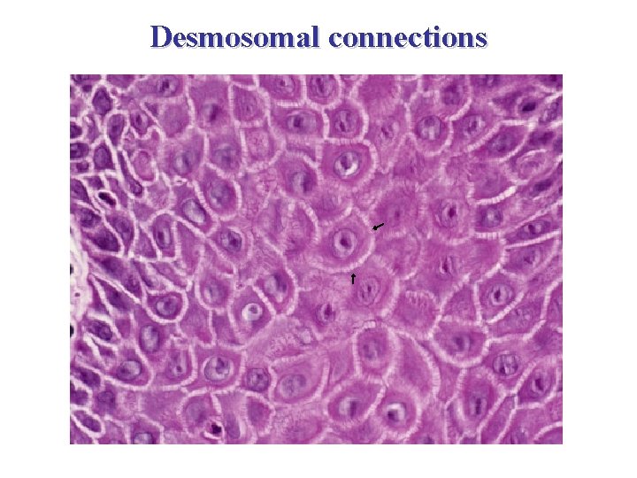 Desmosomal connections 