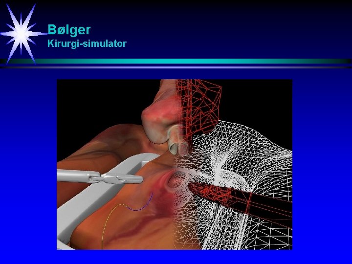 Bølger Kirurgi-simulator 