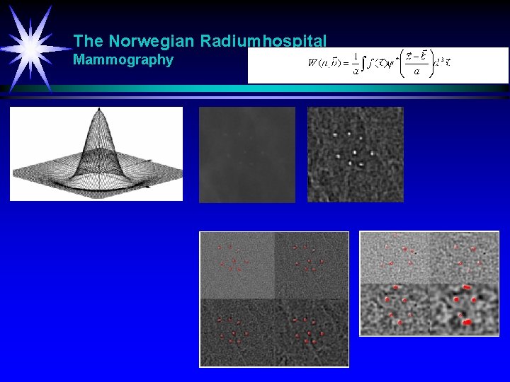 The Norwegian Radiumhospital Mammography 