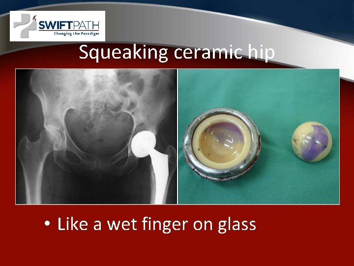 Squeaking ceramic hip • Like a wet finger on glass 