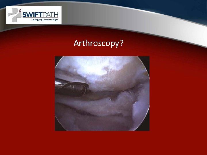 Arthroscopy? 