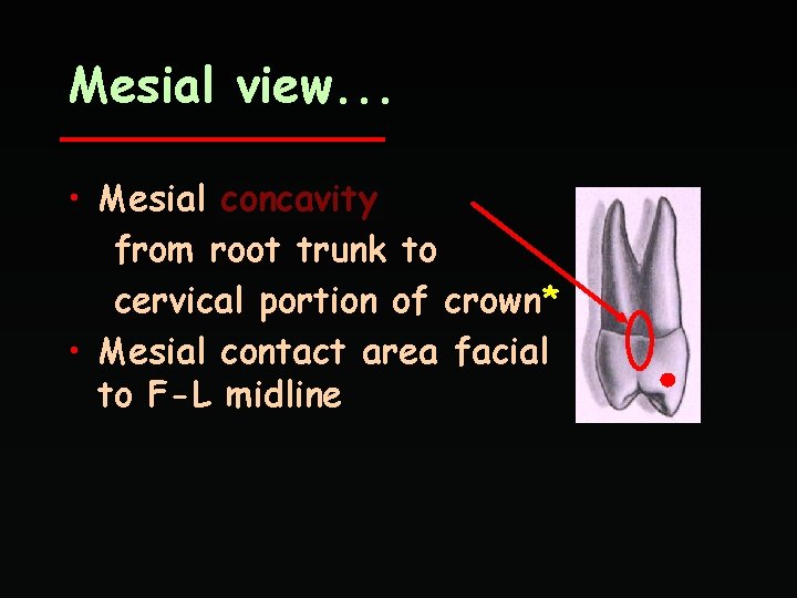 Mesial view. . . • Mesial concavity from root trunk to cervical portion of